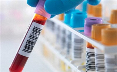 艾滋病是如何感染的？